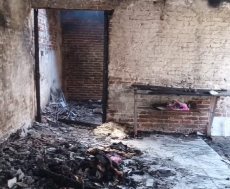 Lee más sobre el artículo Un hombre de 81 años sufrió graves quemaduras y su vida corre peligro