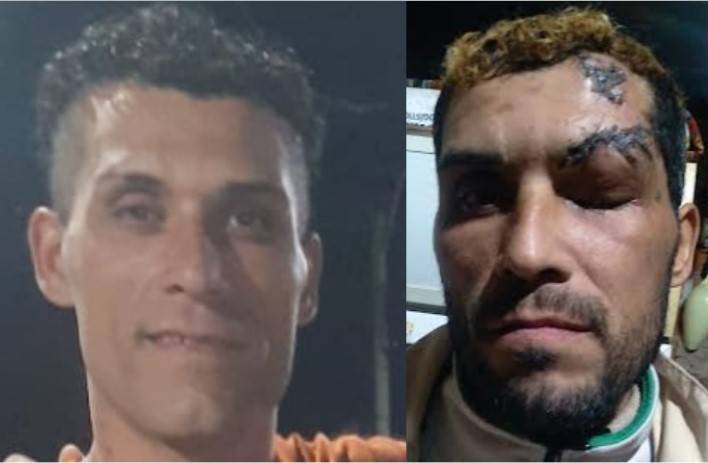 Lee más sobre el artículo Relato estremecedor del «trapito» al que un policía le pegó un tiro en el ojo en la Comisaría de San Nicolás