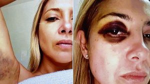 Lee más sobre el artículo La acusación de Fabiola, las fotos de los golpes y el secuestro del teléfono: cómo se desató la causa por violencia contra Alberto Fernández